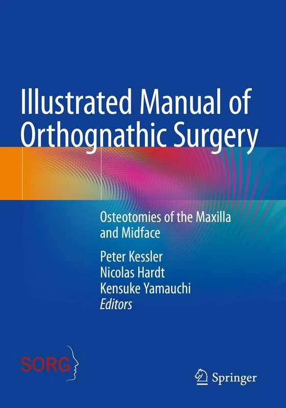 Illustrated Manual of Orthognathic Surgery: Osteotomies of the Maxilla and Midface