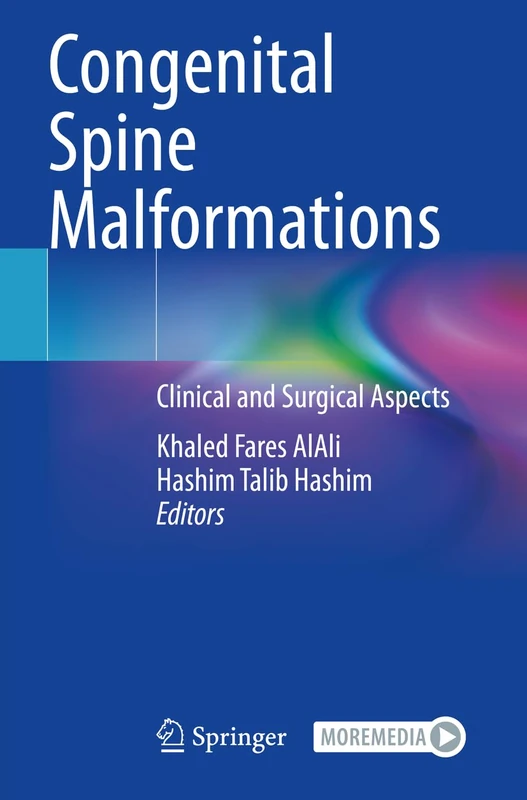 Congenital Spine Malformations: Clinical and Surgical Aspects