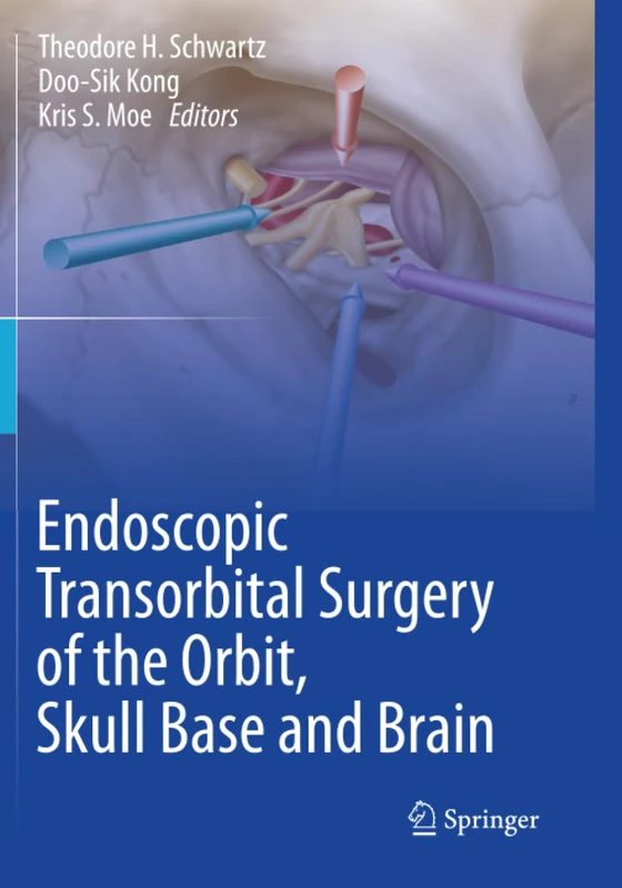 Endoscopic Transorbital Surgery of the Orbit, Skull Base and Brain