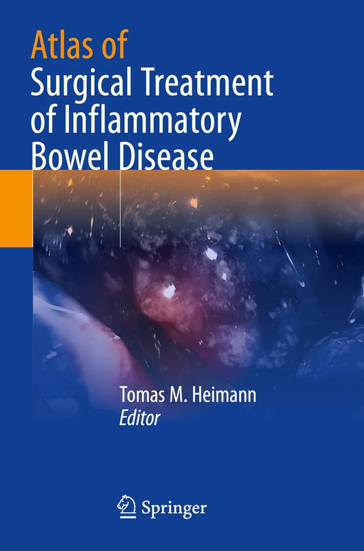 Atlas of Surgical Treatment of Inflammatory Bowel Disease