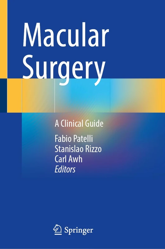Macular Surgery: A Clinical Guide