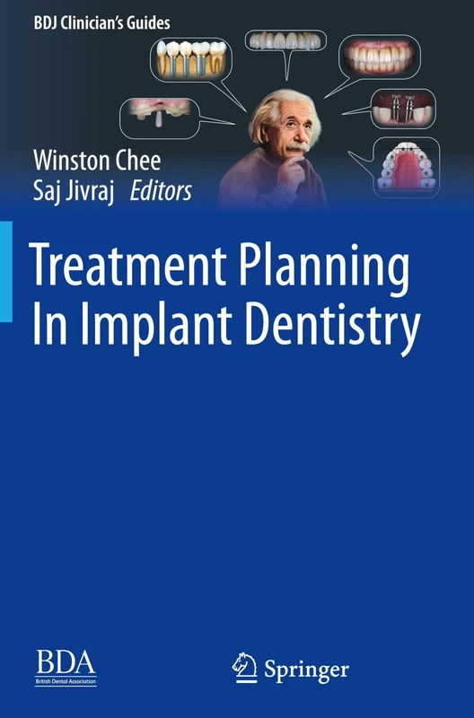 Treatment Planning In Implant Dentistry (BDJ Clinician’s Guides)
