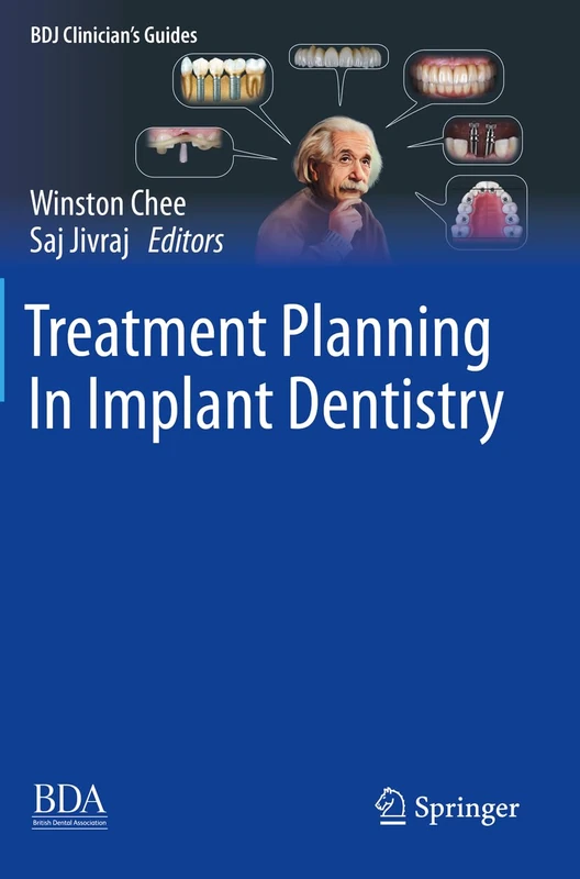 Treatment Planning In Implant Dentistry (BDJ Clinician’s Guides)