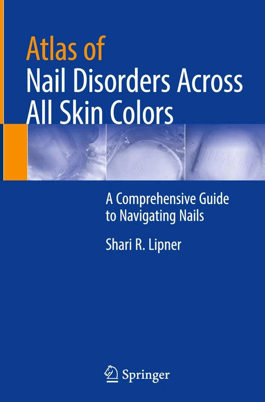 Atlas of Nail Disorders Across All Skin Colors: A Comprehensive Guide to Navigating Nails