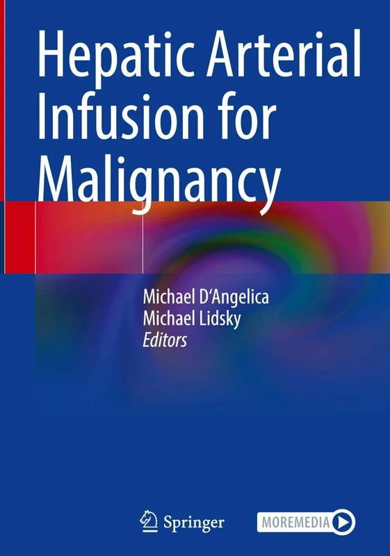 Hepatic Arterial Infusion for Malignancy - Image 1
