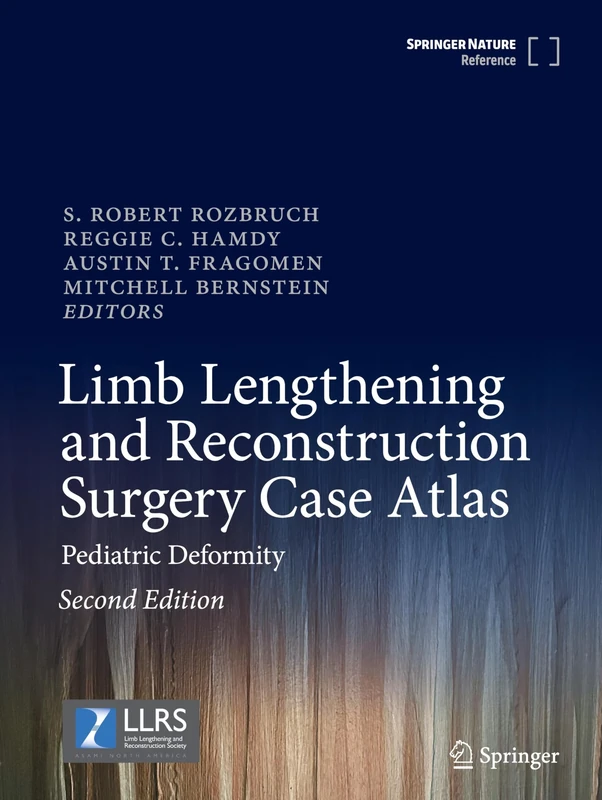 Limb Lengthening and Reconstruction Surgery Case Atlas: Pediatric Deformity