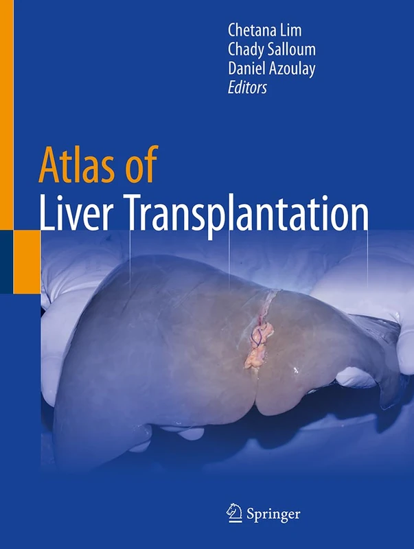 Atlas of Liver Transplantation