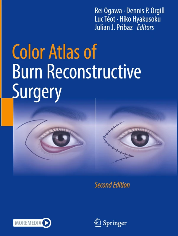 Color Atlas of Burn Reconstructive Surgery