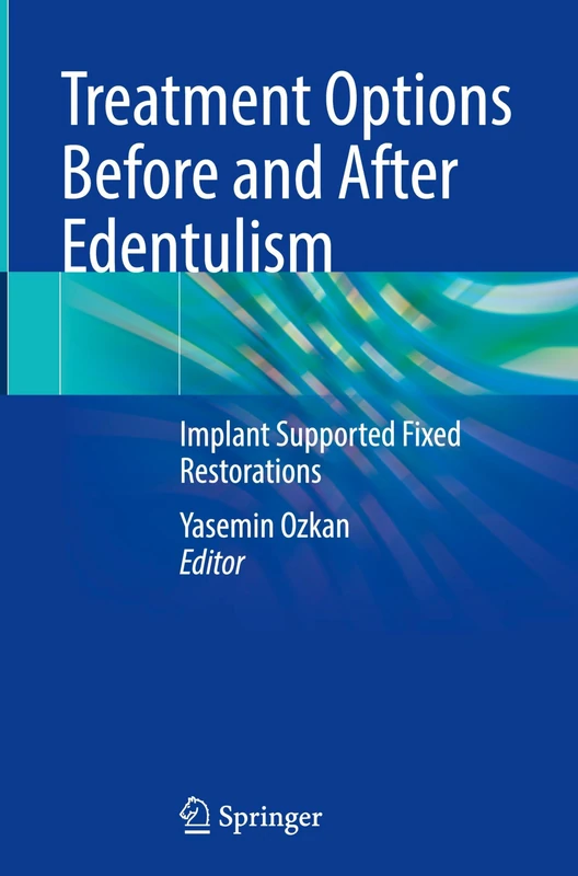 Treatment Options Before and After Edentulism: Implant Supported Fixed Restorations