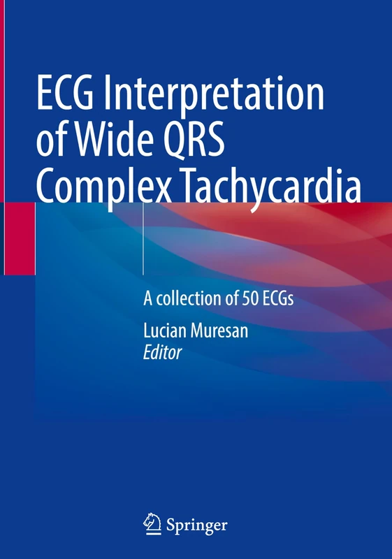 ECG Interpretation of Wide QRS Complex Tachycardia: A collection of 50 ECGs