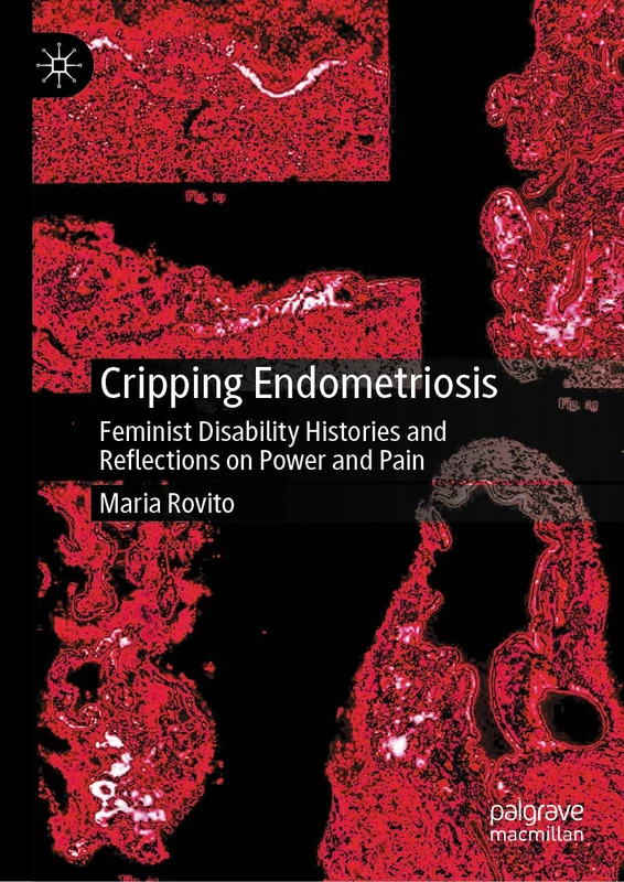 Cripping Endometriosis: Feminist Disability Histories and Reflections on Power and Pain