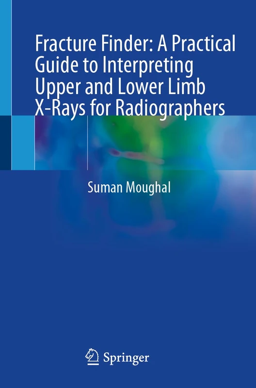 Fracture Finder: A Practical Guide to Interpreting Upper and Lower Limb X-Rays for Radiographers