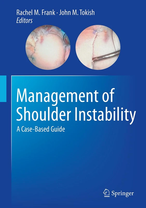 Management of Shoulder Instability: A Case-Based Guide
