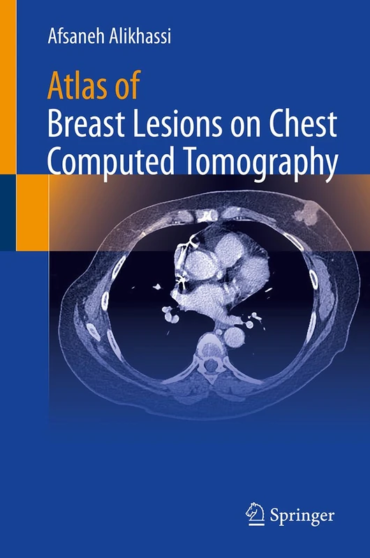 Atlas of Breast Lesions on Chest Computed Tomography