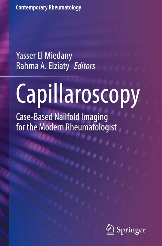 Capillaroscopy: Case-Based Nailfold Imaging for the Modern Rheumatologist (Contemporary Rheumatology)