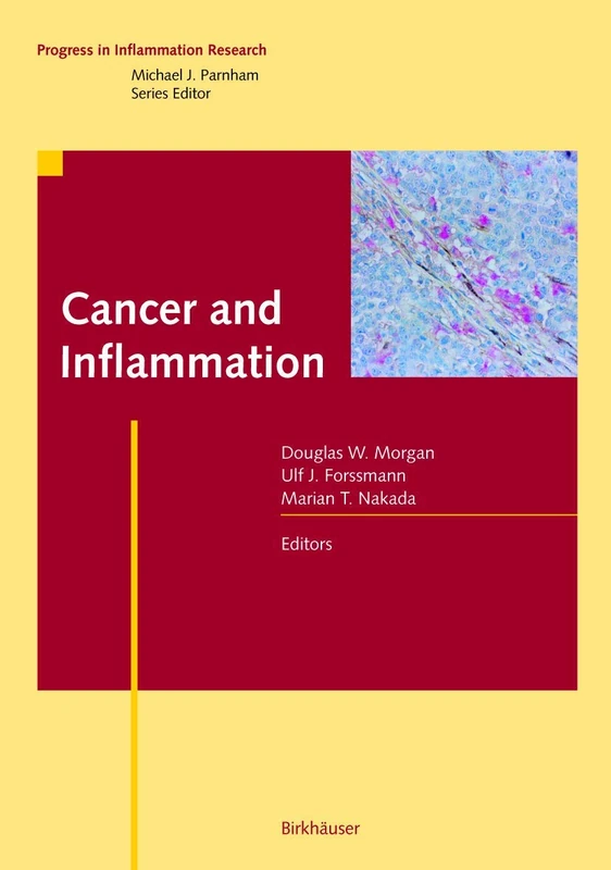 Cancer and Inflammation (Progress in Inflammation Research)