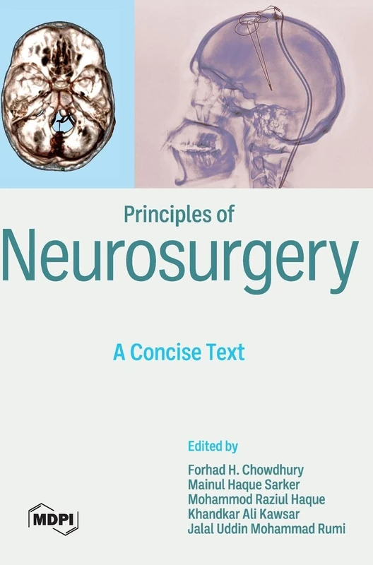 Principles of Neurosurgery: A Concise Text