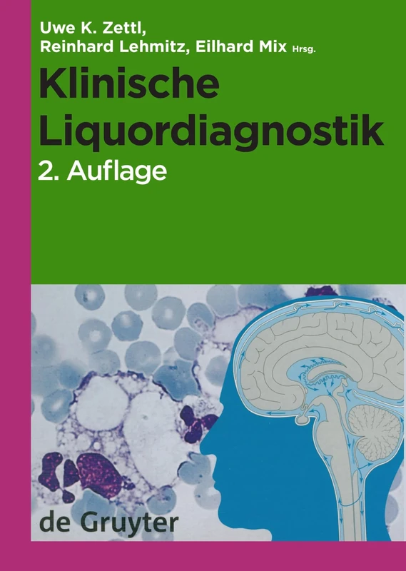 Klinische Liquordiagnostik