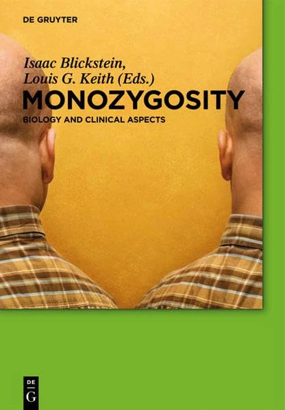 Monozygosity: Biology and clinical aspects