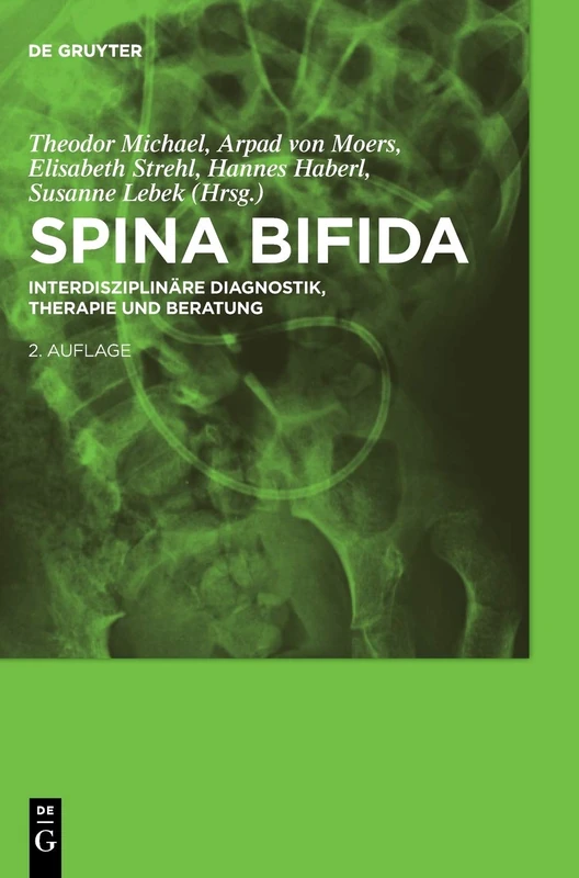 De Gruyter Spina bifida: Interdisziplinare Diagnostik, Therapie