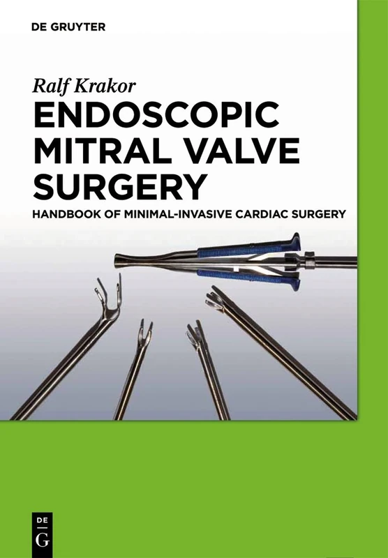 Endoscopic Mitral Valve Surgery: Handbook of Minimal-invasive Cardiac Surgery