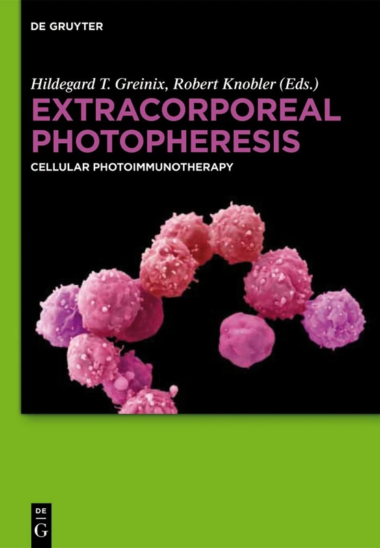 Extracorporeal Photopheresis: Cellular Photoimmunotherapy - Image 1