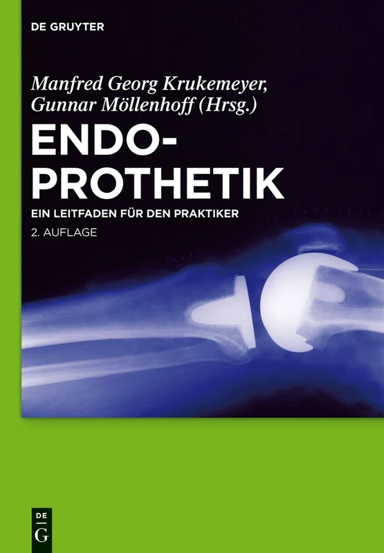 Endoprothetik: Ein Leitfaden für den Praktiker