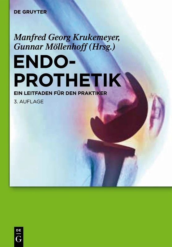 De Gruyter Endoprothetik: Ein Leitfaden Fuer Den Praktiker