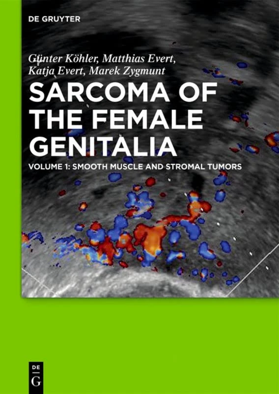Smooth Muscle and Stromal Tumors and Prevention of Inadequate Surgery: Smooth Muscle and Stromal Tumors