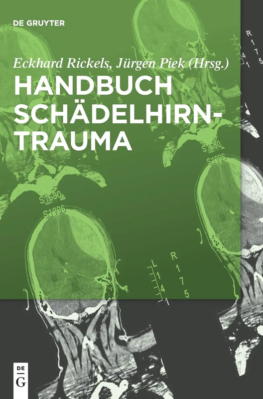 Handbuch Schädelhirntrauma - Image 1