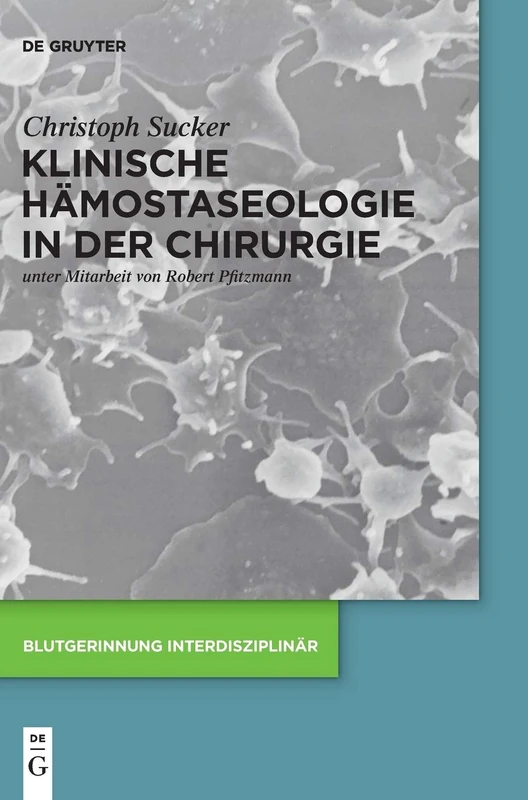Klinische Hämostaseologie in der Chirurgie (Blutgerinnung interdisziplinär)