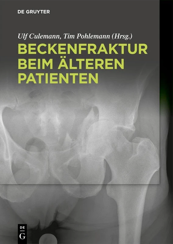 De Gruyter - Beckenfraktur beim alteren Patienten Book