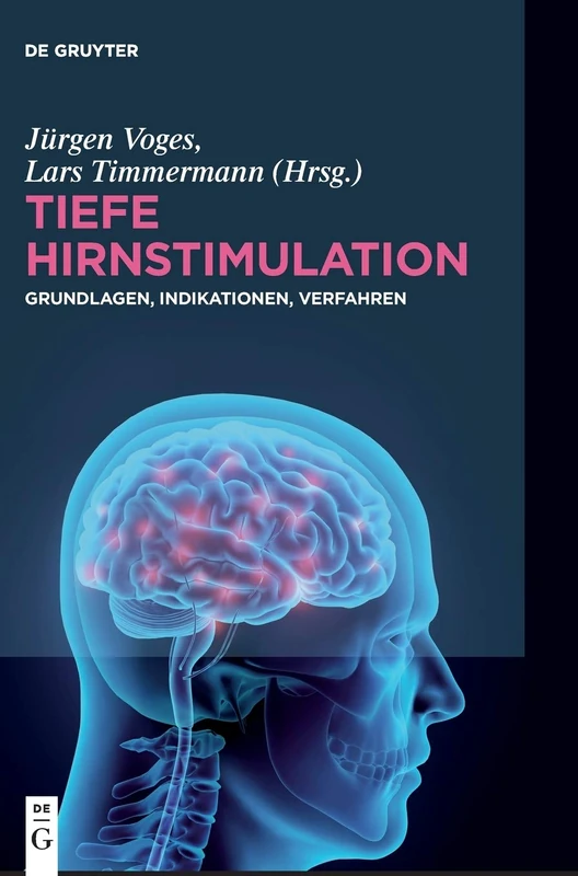Tiefe Hirnstimulation: Grundlagen, Indikationen, Verfahren