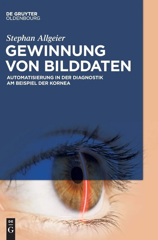 Gewinnung von Bilddaten: Automatisierung in der Diagnostik am Beispiel der Kornea - Image 1