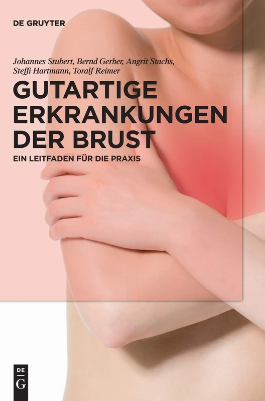 Gutartige Erkrankungen der Brust: Ein Leitfaden für die Praxis - Image 1