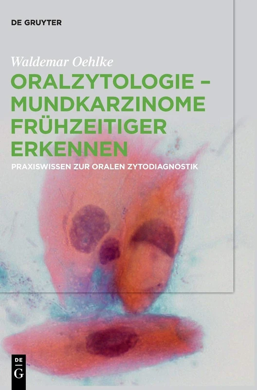 Oralzytologie - Mundkarzinome frühzeitiger erkennen: Praxiswissen zur Oralen Zytodiagnostik