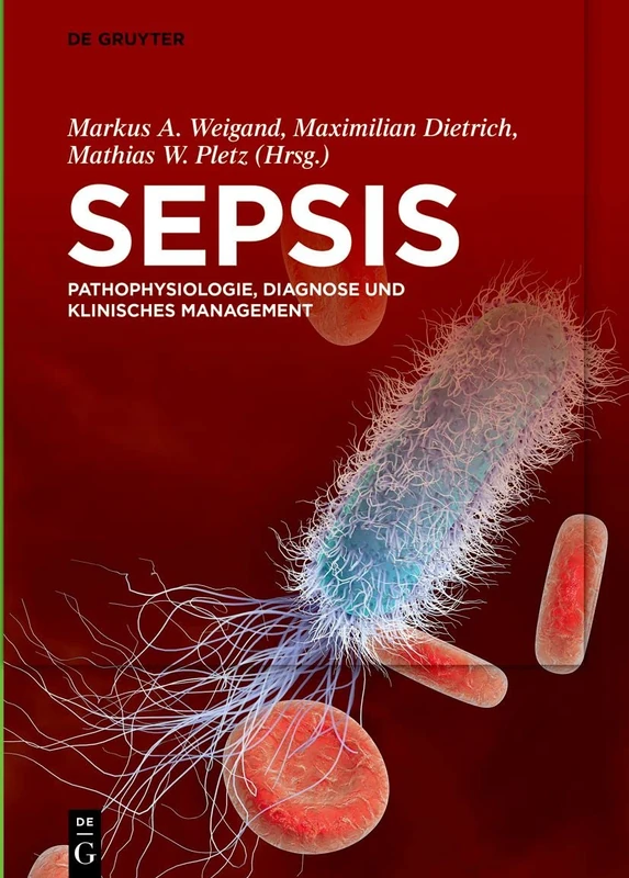 Sepsis: Pathophysiologie, Diagnose und klinisches Management