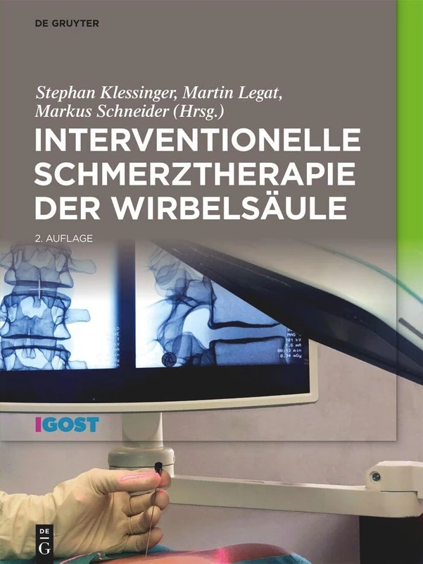 Interventionelle Schmerztherapie Der Wirbelsäule
