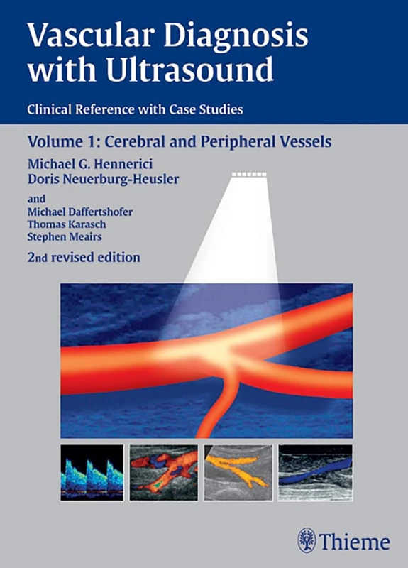 Vascular Diagnosis with Ultrasound: Clinical Reference with Case Studies: Vol. 1: Cerebral and Peripheral Vessels: v. 1