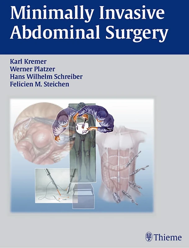 Minimally Invasive Abdominal Surgery: Surgical Anatomy, Indications, Techniques, Complications: Laparascopic and Thoracic Surgery