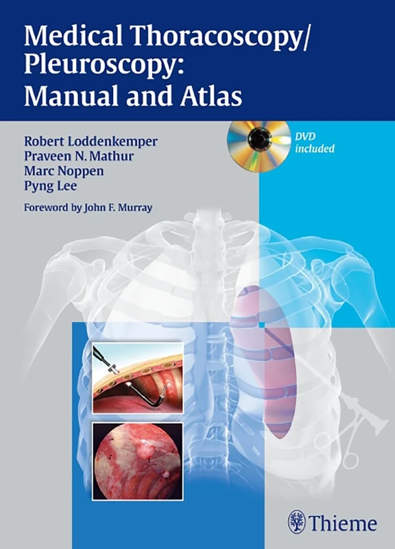 Medical Thoracoscopy/Pleuroscopy: Manual and Atlas