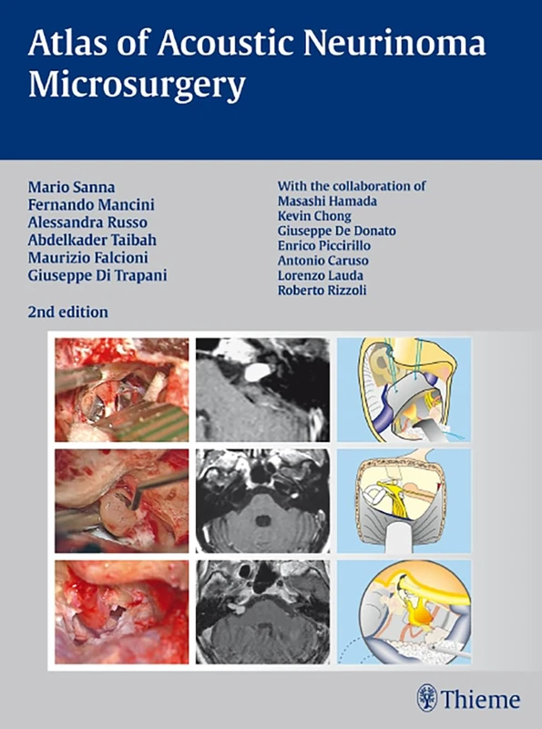 Atlas of Acoustic Neurinoma Microsurgery: . Zus.-Arb.: Mario Sanna Essam Saleh, Benedict Panizza, Alexandra Russo, Abdel TaibahWith the collaboration of Refik Caylan, Fernando Mancini ...