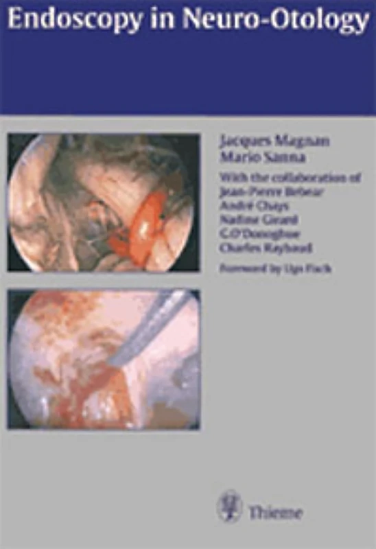 Endoscopy in Neuro-Otology: . Zus.-Arb.: Jacques Magnan, Mario Sanna With Contributions by...