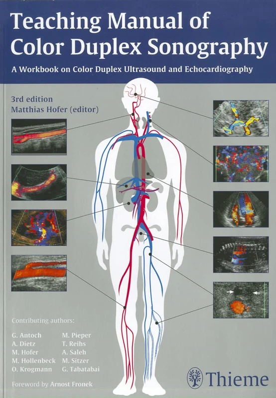 Teaching Manual of Color Duplex Sonography