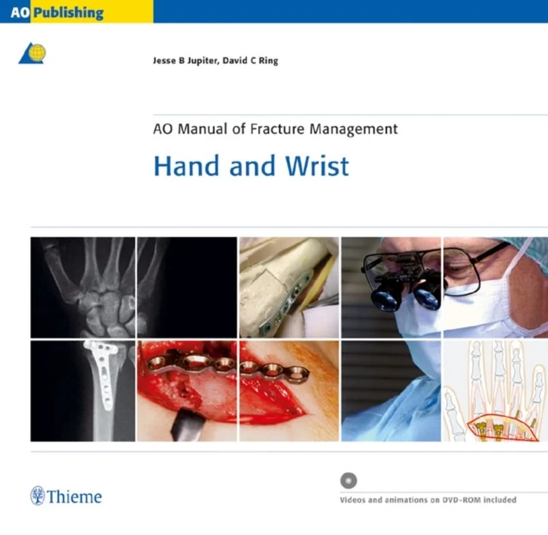 AO Manual of Fracture Management: Hand and Wrist, Book & DVD (AO-Publishing)