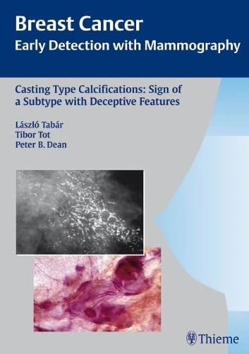 Casting Type Calcifications: Sign of a Subtype with Deceptive Features: v. 2 (Breast Cancer - Early Detection with Mammography): Sign of a Subtype With Unpredictable Outcome (Tabar Mammo)