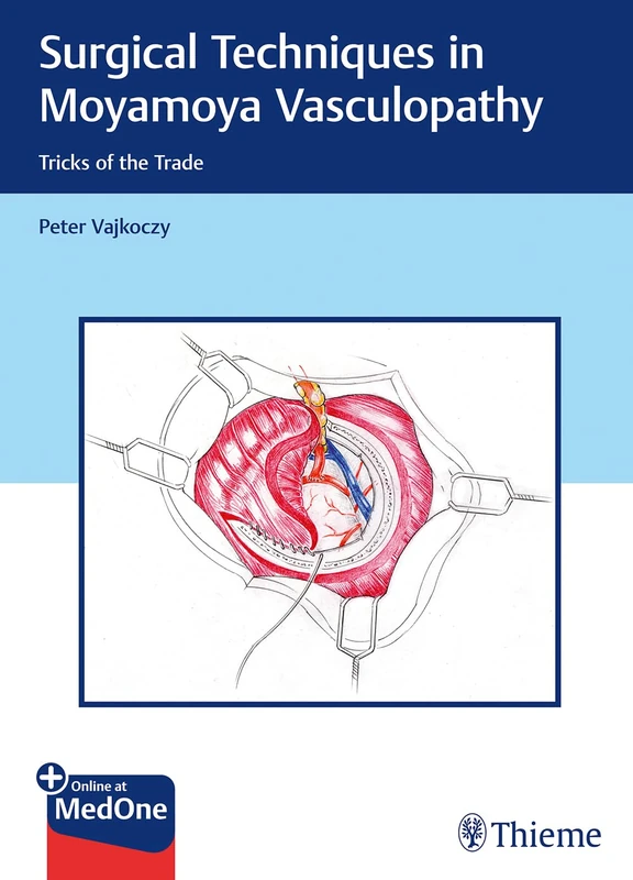 Thieme Surgical Techniques in Moyamoya Vasculopathy Book