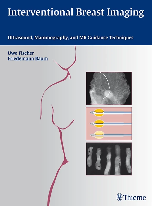 Interventional Breast Imaging: Ultrasound, Mammography, and MR Guidance Techniques