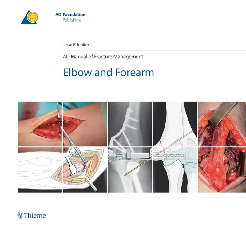 AO Manual of Fracture Management: Elbow & Forearm (AO-Publishing)