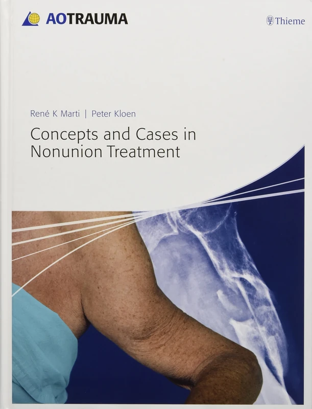 Concepts and Cases in Nonunion Treatment (AO Trauma Handbooks)